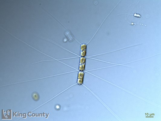 Photo of Chaetoceros similis